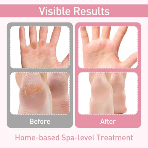 HANNEA 4 Pairs Moisturizing Glove Socks Set, Silicone Gel Spa Socks for Dry Cracked Skin, Silicone Gel Heel Socks Anti Slip, for Foot Hand Softening, Calluses, Foot Care After Pedicure HANNEA 4 Pairs Moisturizing Glove Socks Set, Silicone Gel Spa Socks for Dry Cracked Skin, Silicone Gel Heel Socks Anti Slip, for Foot Hand Softening, Calluses, Foot Care After Pedicure